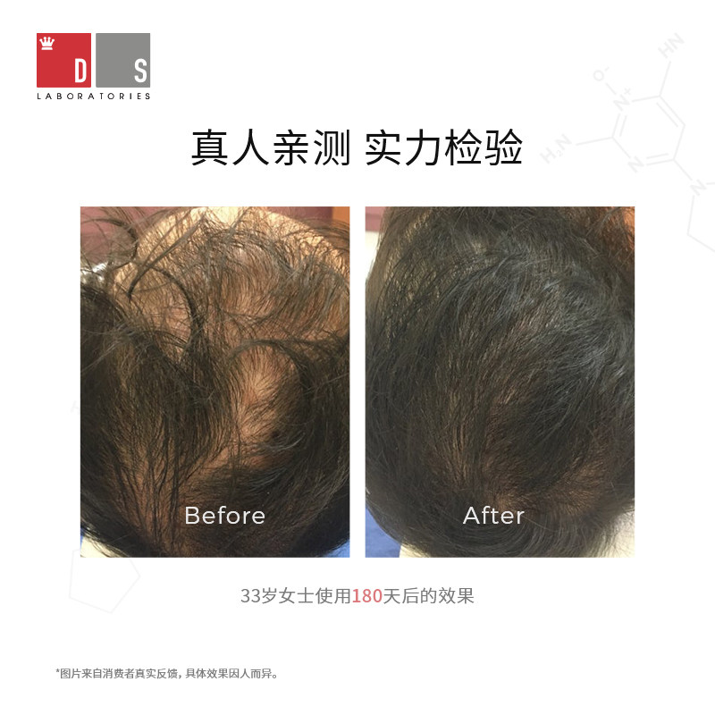 【团购专享】DS实验室纳诺地尔防脱育发K精华增密厚发液非米诺地高性价比高么？