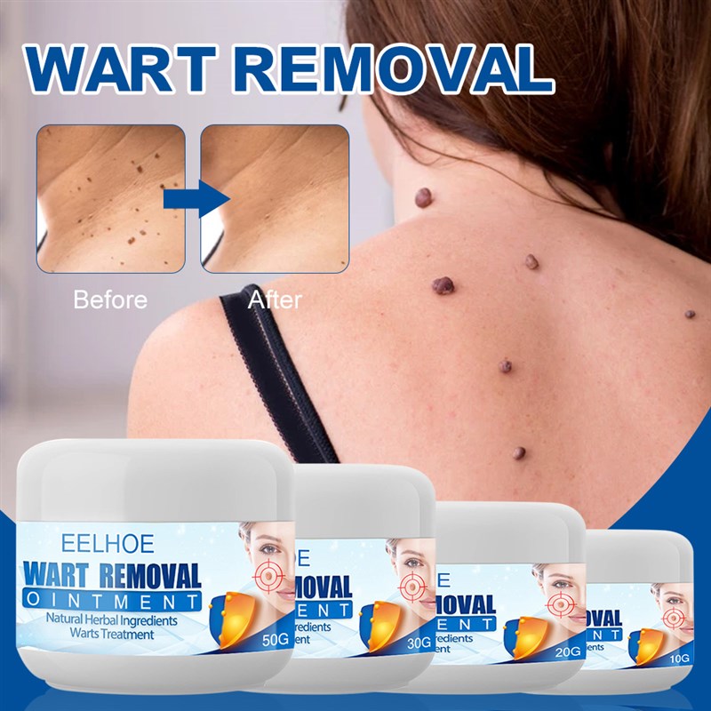 推荐Wart Remover Safe Painless Skin Tags Removal Ointment Fa-封面