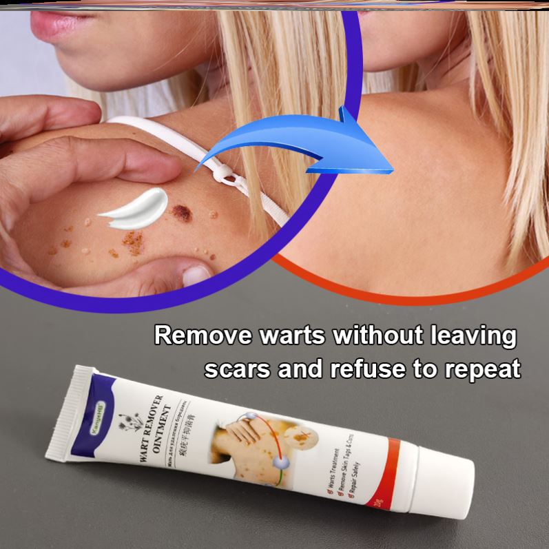 速发highquality Warts Remover Ointment Wart Treatment Cream
