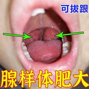 推荐【最快三天】腺样体肥大草本贴膏儿童张嘴呼吸调理男女打呼噜