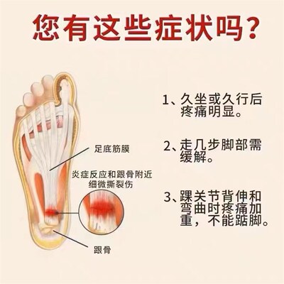 推荐足跟痛专用药脚底板疼痛足底筋膜炎脚后跟疼韧带拉伤足跟疼痛