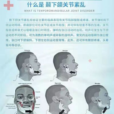 颞下颌关节紊乱热敷下巴袋大小脸偏弹响牙齿矫正器治疗张口受限症