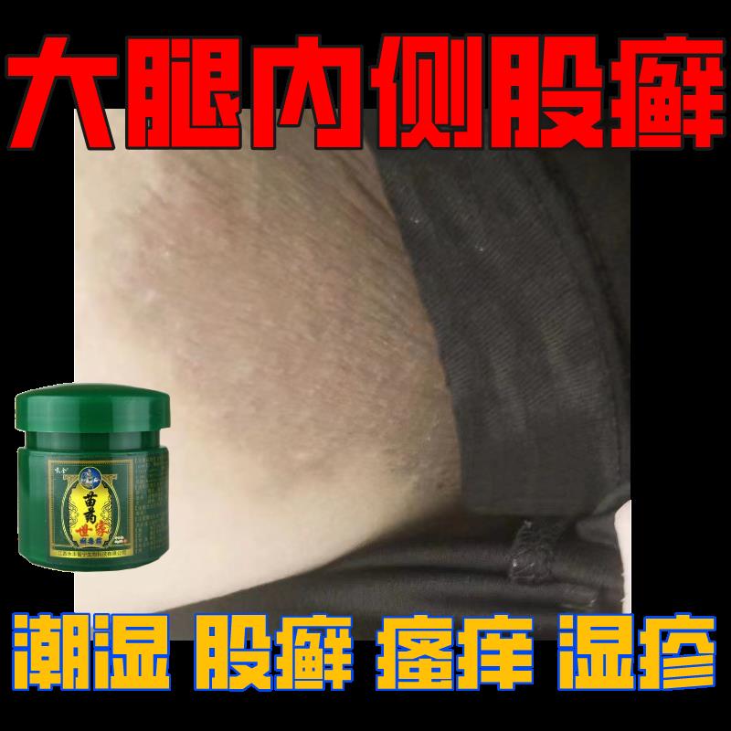 极速大腿根部潮湿瘙痒股癣大腿根内侧湿疹大腿内侧瘙痒发黑大腿内