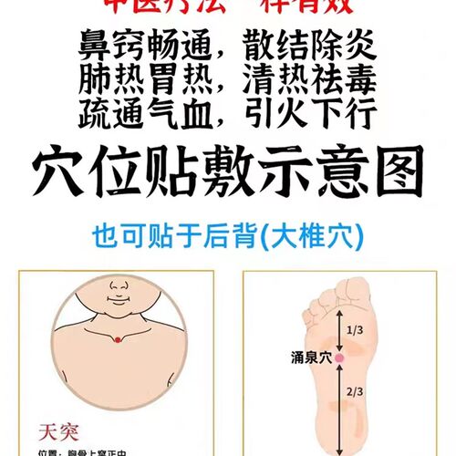 工厂销儿童腺f样体肥大调理面容矫正器睡觉张嘴呼吸不通气鼻塞打