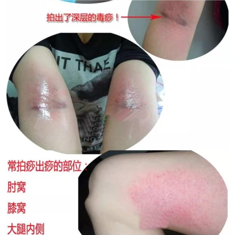 拍痧板硅c胶经络拍打拍拍棒肩颈敲打按摩健身锤腿拍养生2只装