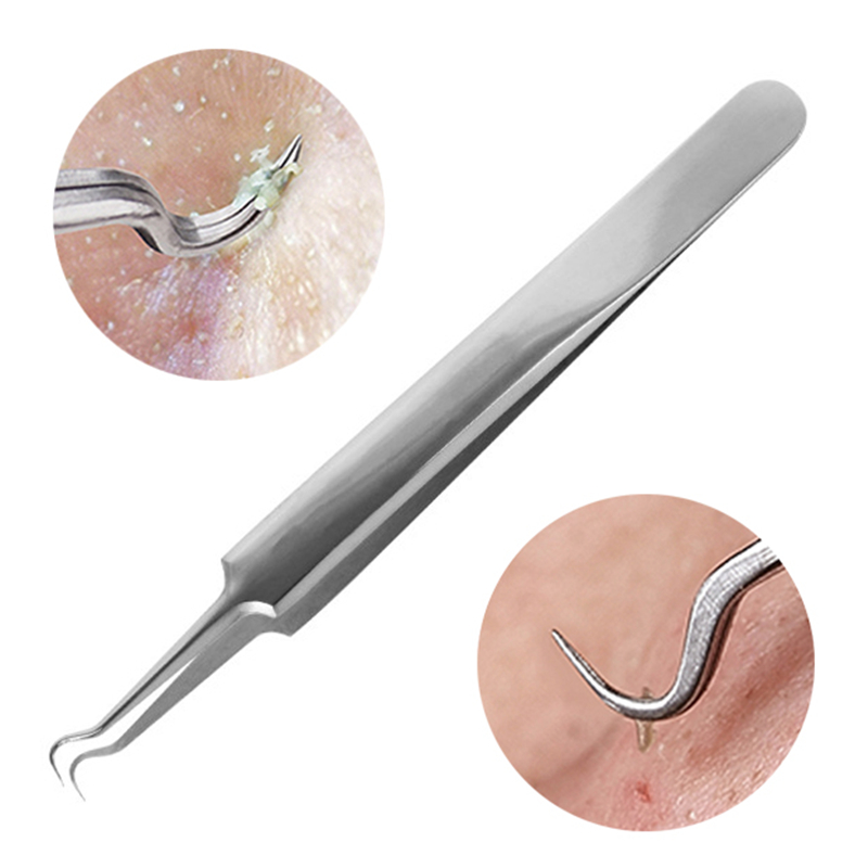 速发Stainless Steel Acne Removal Needles Pimple Blackhead Re