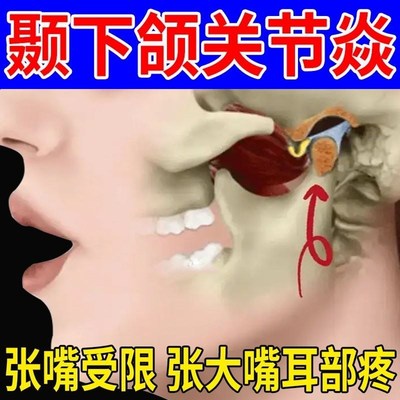 推荐颞下颌【一张嘴就疼专用】下巴疼腮帮子疼张不开嘴耳後疼痛