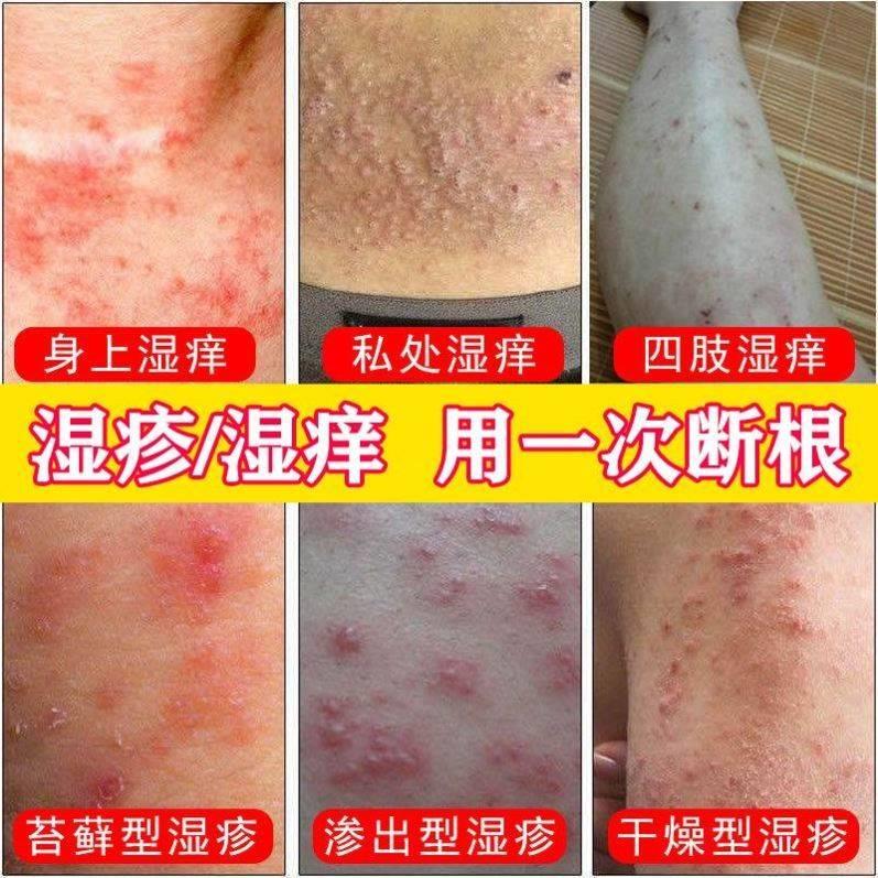 速发仲佰百堂皮肤抑菌膏【官网正品】买二送一柏瑞锐堂芙舒美旗舰-封面