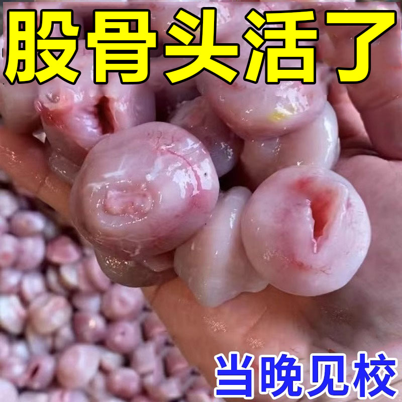 热销100%冶坏死】股骨头髋关节疼痛缺血坏死肿胀疼痛股骨头坏死专