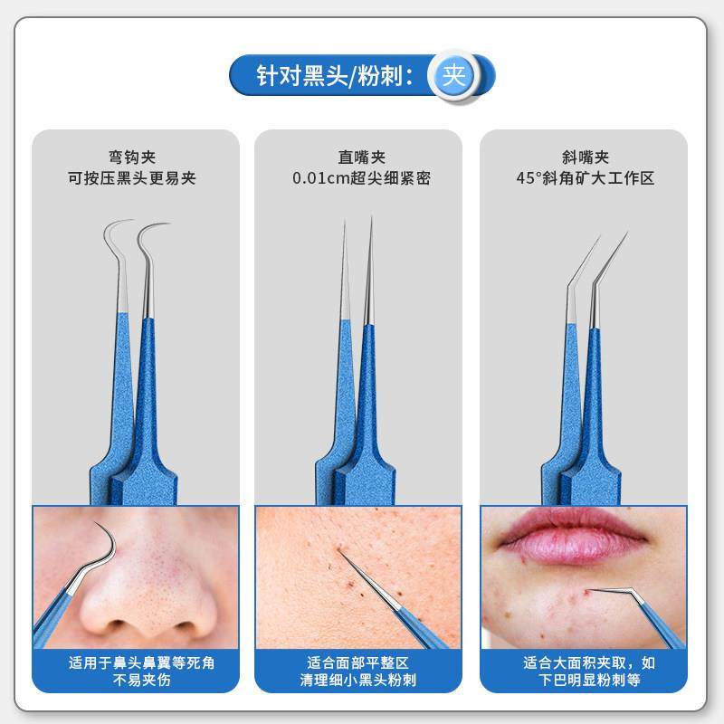 网红粉刺针黑头夹去痘痘工具套装美容院刮闭口针镊子挑暗疮排针一