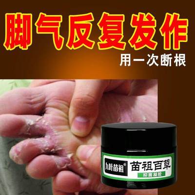 极速九叶苗祖苗族百草抑菌凝胶治脚七脚臭脚痒脱皮汗脚乾裂水泡脚