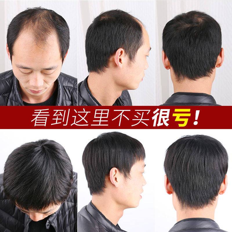 男士头顶补发片假发男时尚寸头隐形真发遮盖白发纹理烫假发片