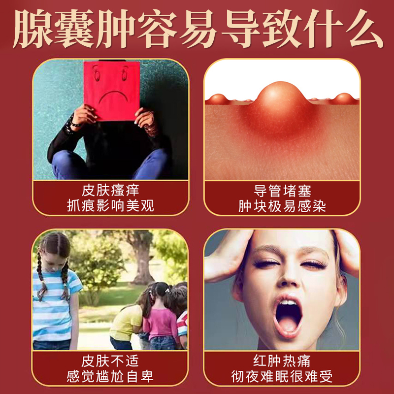 现货速发火疖子拔毒拔脓膏神器硬块屁股上长痘痘坐疮膏痒药火疖子