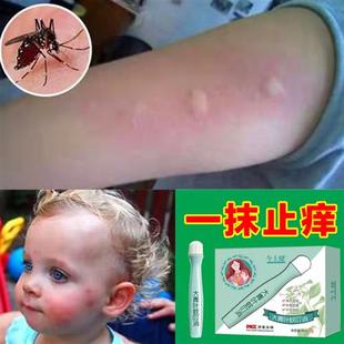 推荐 儿童婴儿防跳蚤蚊子蚊虫叮咬止痒消儿童肿成人宝宝婴儿蚊子药