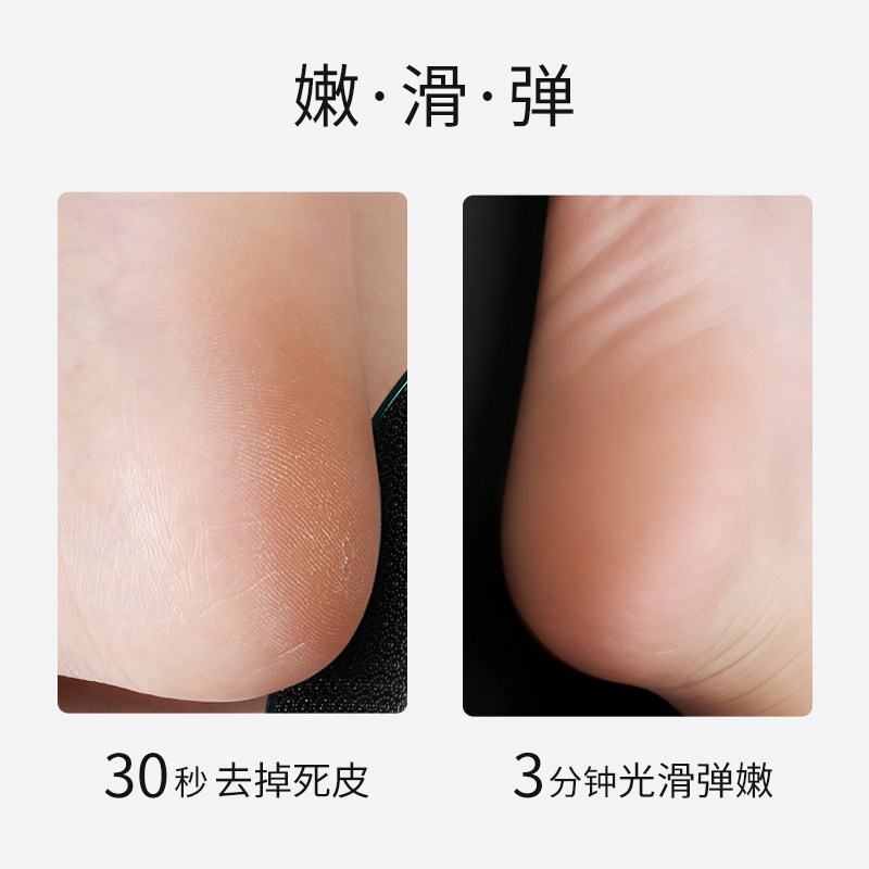 磨脚石刮脚后跟去死皮脚底磨脚器去脚皮老茧搓脚工具磨脚神器死皮