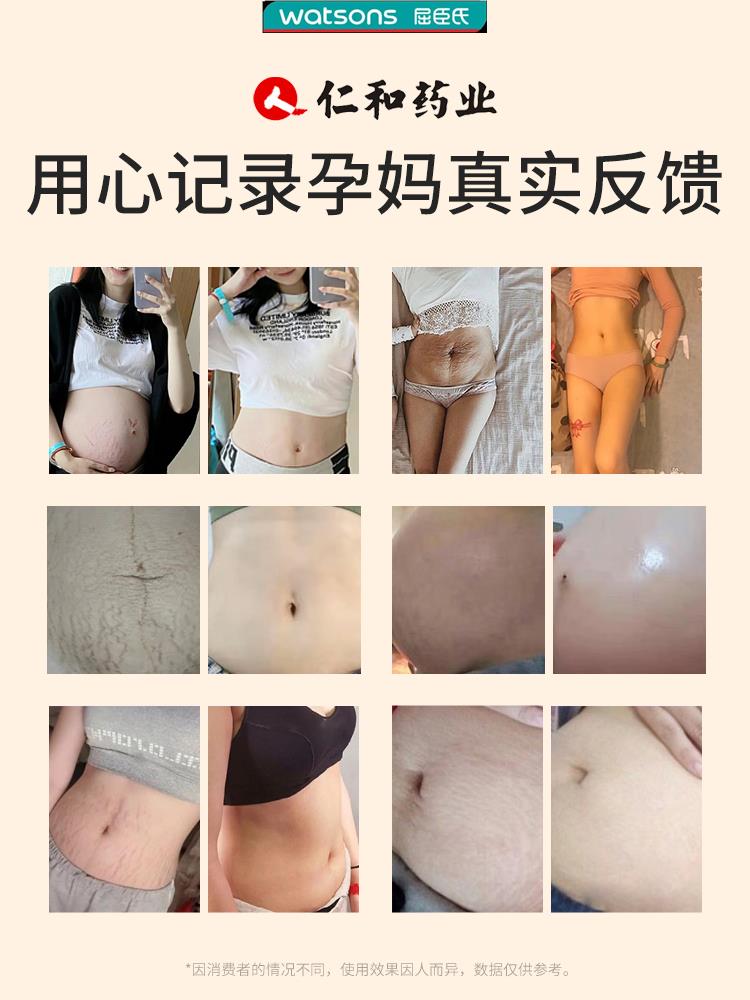 仁和橄榄油孕妇妊娠纹油预防产后专用淡化护理除肥胖生长纹修复霜