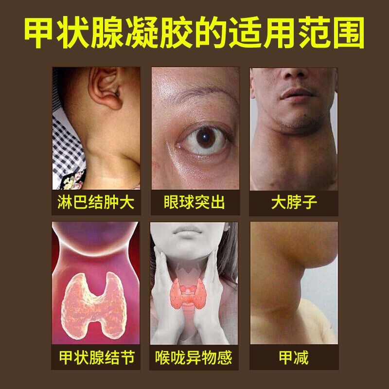 推荐甲状腺散结膏【结节立可肖】甲状...