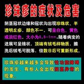 龟炎清消龟鬼头炎男科用药霉菌性珍珠疹瘙痒膏红点止痒包皮垢 推荐