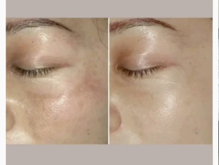 正品官方认证柏泉夫人调肤源泉秀肤售后资深老师指导