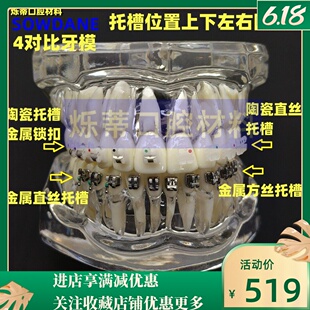 牙科模型正畸牙模型4种托槽对比模型医患沟通展示教学齿科