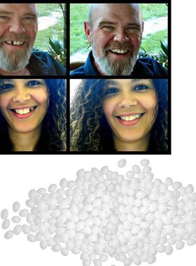 Tooth-Repair-Set Glue Denture Adhesive Dentist False-Teeth R