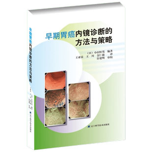早期胃癌内镜诊断的方法与策略 (日)小山恒男 编著;王亚雷,王川,金仁德 译 正版书籍 新华书店旗舰店文轩官网 辽宁科学技术出版社