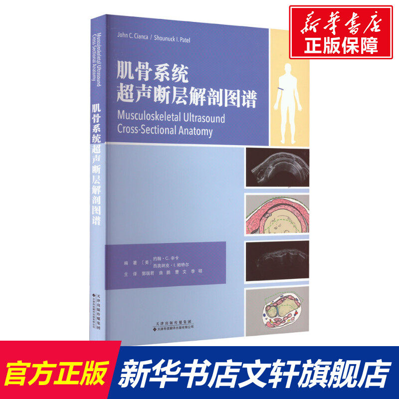 肌骨系统超声断层解剖图谱 正版书籍 新华书店旗舰店文轩官网 天津科技翻译出版有限公司使用感如何?