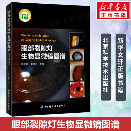 眼部裂隙灯生物显微镜图谱 魏文斌,卿国平 主编 正版书籍 新华书店旗舰店文轩官网 北京科学技术出版社