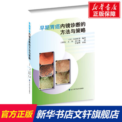 【新华文轩】早期胃癌内镜诊断的方法与策略 (日)小山恒男 编著;王亚雷,王川,金仁德 译 正版书籍 新华书店旗舰店文轩官网