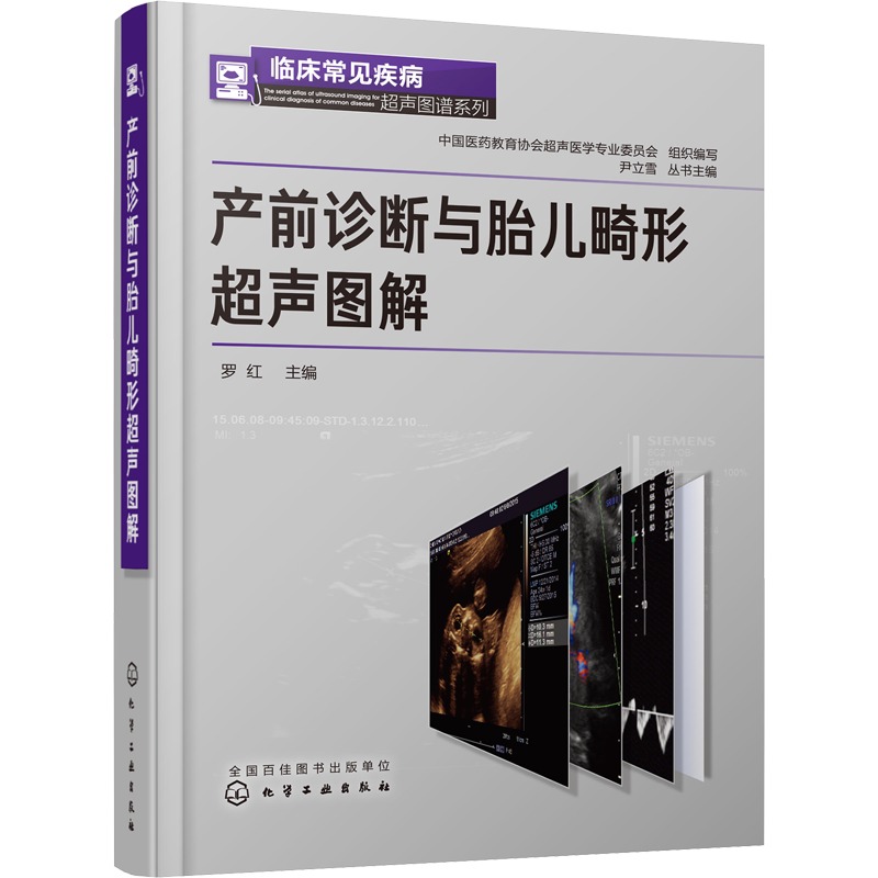 产前诊断与胎儿畸形超声图解 正版书籍 新华书店旗舰店文轩官网 化学工业出版社