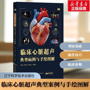 【新华文轩】临床心脏超声典型病例与手绘图解 心脏超声基础学习临床诊断治疗 心胸外科影像学护理学实用指南 医学正版书籍