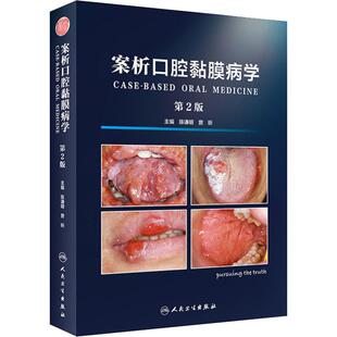 案析口腔黏膜病学 第2版 正版书籍 新华书店旗舰店文轩官网 人民卫生出版社
