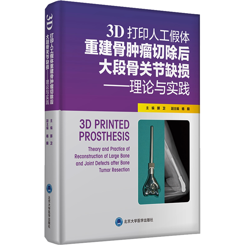 3D打印人工假体重建骨肿瘤切除后大段骨关节缺损——理论与实践 正版书籍 新华书店旗舰店文轩官网 北京大学医学出版社