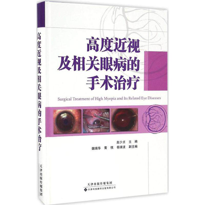 高度近视及相关眼病的手术治疗 赵少贞 主编 正版书籍 新华书店旗舰店文轩官网 天津科技翻译出版有限公司