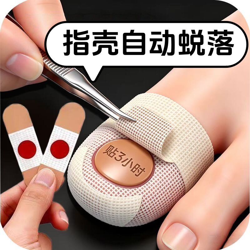 【国药热销】一次性净甲指甲贴正品专用贴植物萃取脚趾手指甲专用