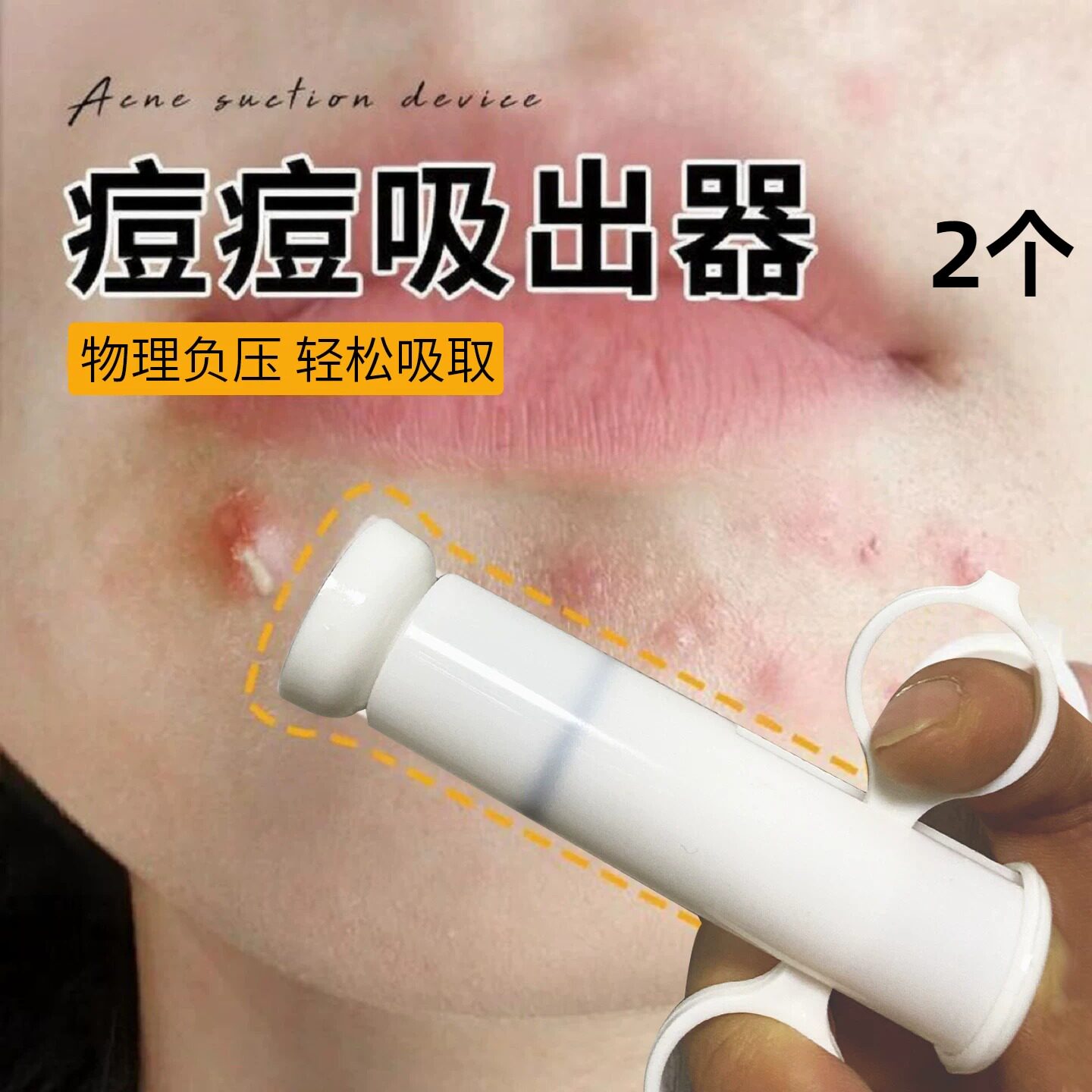 痘痘吸出器男女脸部面部毛囊暗疮专用粉刺毛孔手动美容清洁工具