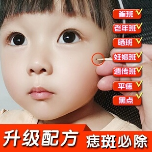 官方旗舰店正品美容金水修复液套装点痣点斑祛痣去班药水不留疤痕