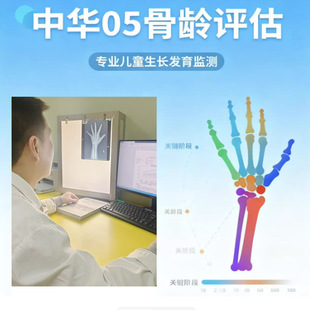 中华05看骨龄片解读鉴定评估生长发育分析矮小性早熟咨询生长激素