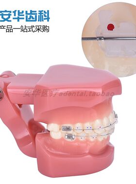 牙科半金属半陶瓷托槽对比模型