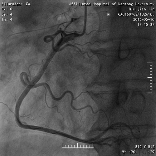 dicom数字软件图文报告打印