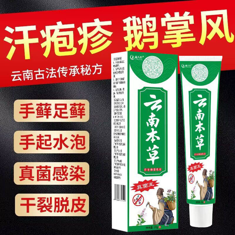 手上起小水泡汗状疱疹止痒汉状真动物保健品