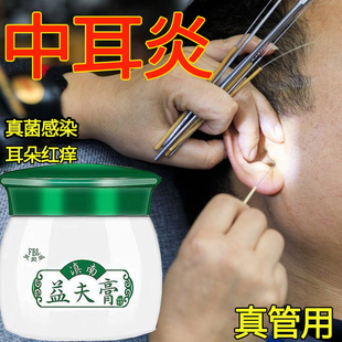 外耳道炎真菌性中耳炎专用药流脓人用药膏可除根烂耳朵滴耳液湿疹