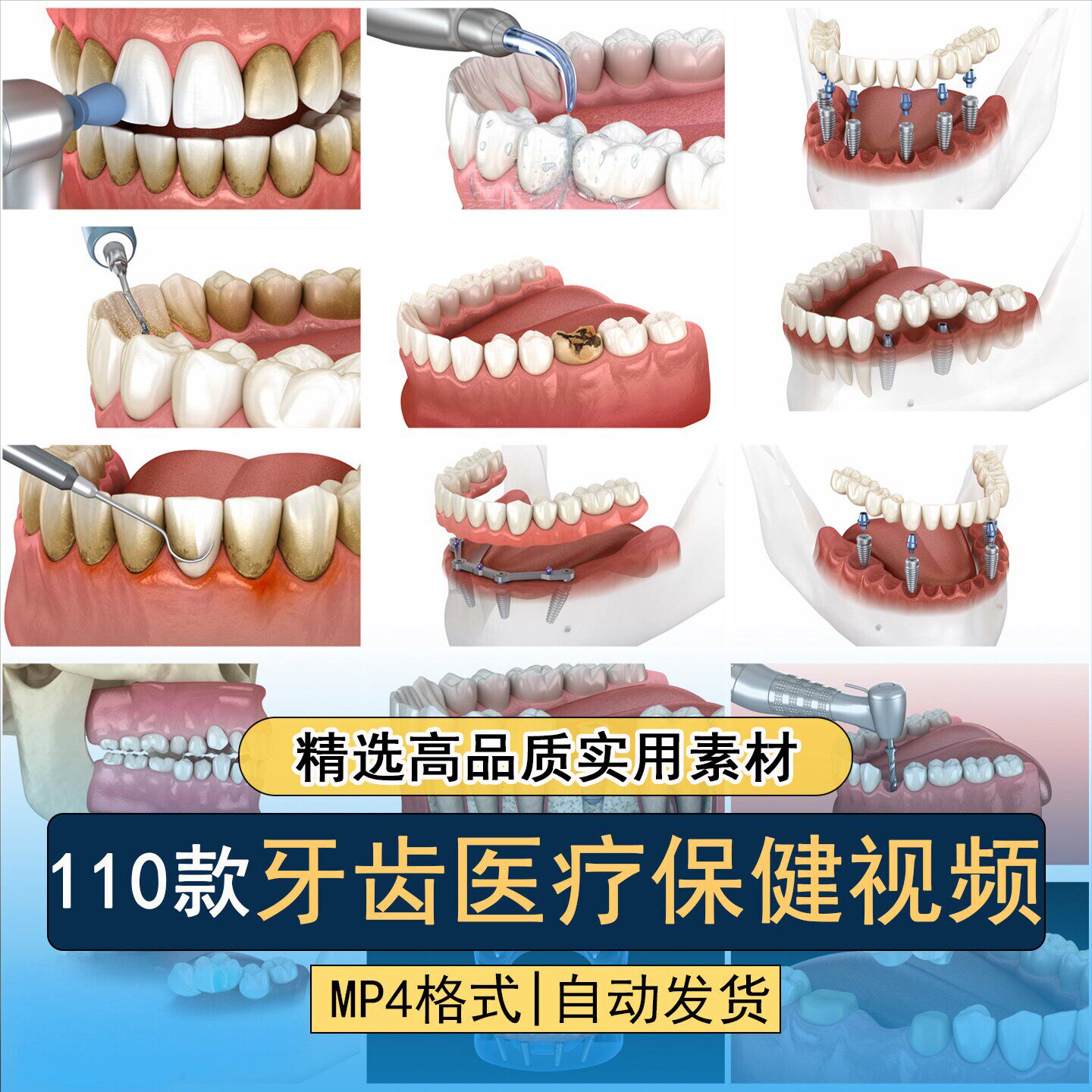 牙科牙齿医疗保健蛀牙拔牙洗牙补牙镶牙种植假牙口腔健康视频素材