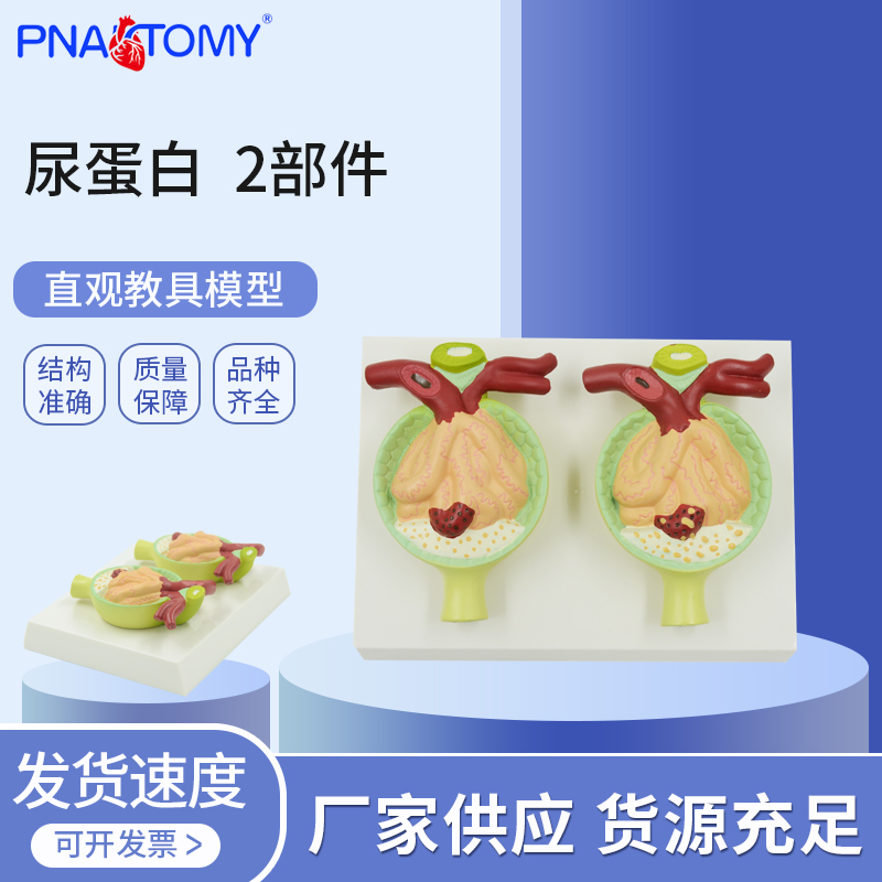 医学教学尿蛋白病理演示模型肾小球滤膜肾小管蛋白尿肾脏微观尿液