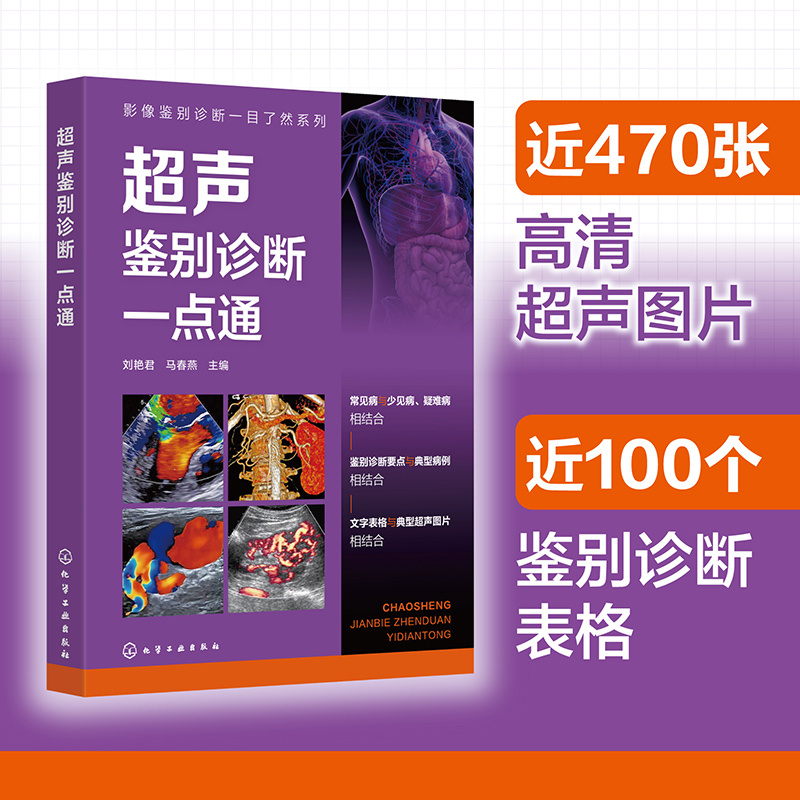 超声鉴别诊断一点通 影像鉴别诊断一目了然系列 常见疾病及罕见病鉴别诊断要点 临床鉴别典型病例参考 超声科医生及研究生参考书籍