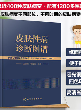 新版 皮肤性病诊断图谱 皮肤科皮肤病性病知识书籍大全专业医学技术中医西医医学皮肤病学教材书细菌真菌病毒感染性皮肤性疾病手册