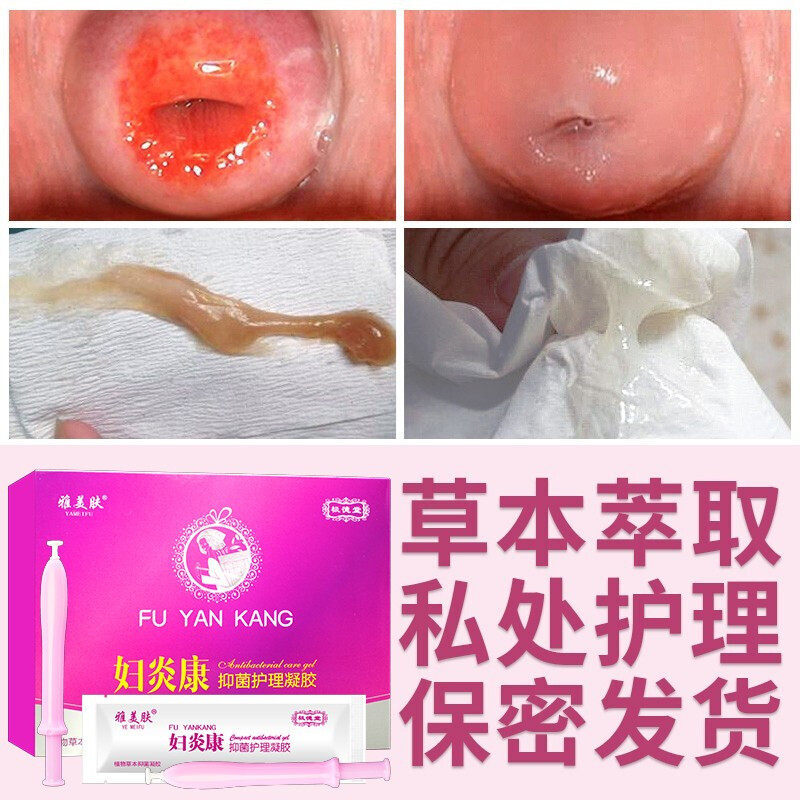 雅美肤妇炎康妇科抑菌凝胶正品私密护理阴道凝胶白带豆腐渣止痒女