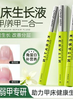 CandyMoyo护甲油指甲护理营养油生长水笔 强韧甲面指缘油增长液31