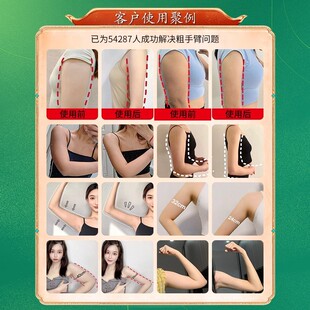 快速去手臂神器大粗胳膊细蝴蝶减拜拜肉粗粗臂女神贴 买3送2