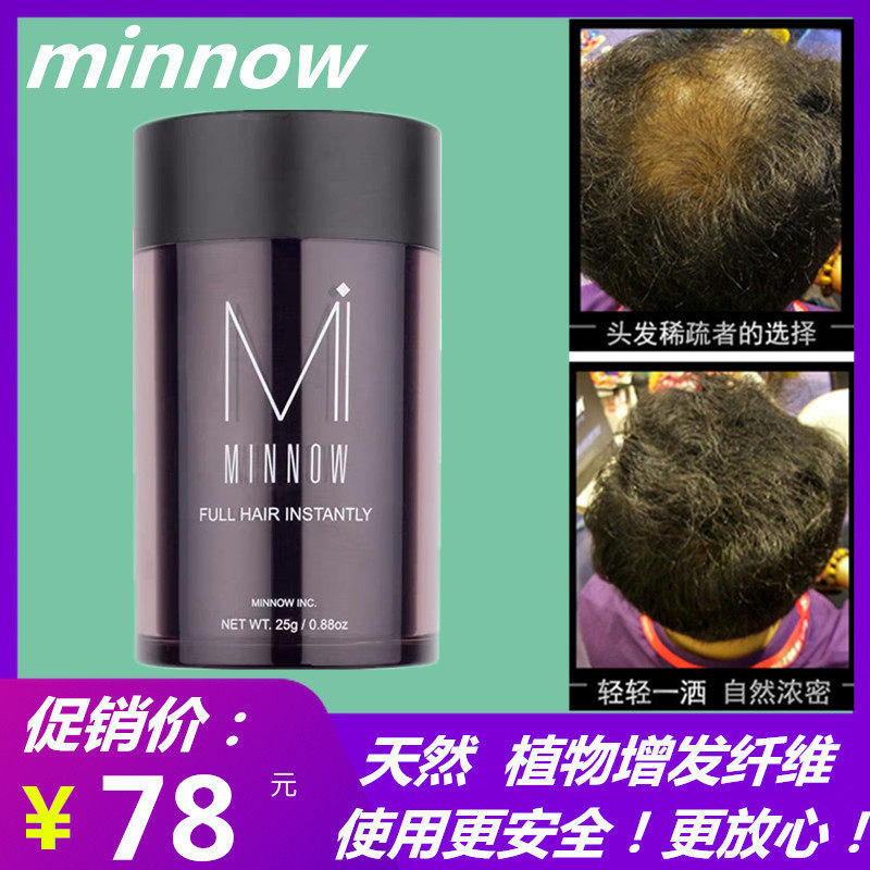 MInnow法国补发增发纤维浓密发神器顶速密头发增密增加发量美发粉